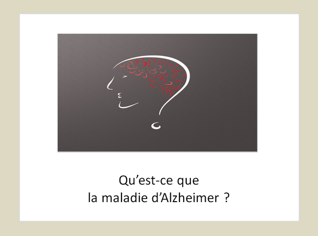 Qu'est-ce que la maladie d'Alzheimer ?